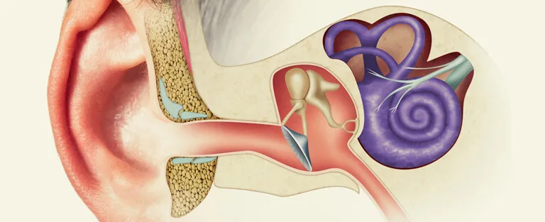 Audio Vestibular